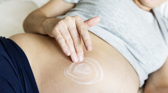 Cicatricea de dupa cezariana. Ce sanse de vindecare au cicatricele cheloide sau hipertrofice